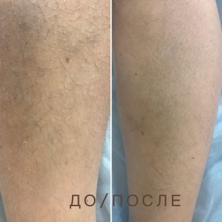 Депиляция  - купить на сайте объявлений Армавир онлайн